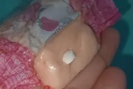 Menina passa mal após comer doce dado por 'Papais Noéis' - Imagem