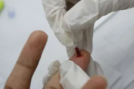 Registro de HIV entre idosos aumenta 441% em 10 anos e preocupa especialistas - Imagem