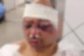 Rodoviário de Salvador é espancado por moradores após suspeita de aliciar adolescente - Imagem