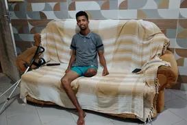 "Se não demorasse tanto tinha como recuperar", diz entregador amputado - Imagem