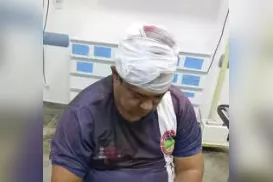 Socorrista é golpeado na cabeça com facão após discussão na Bahia - Imagem