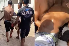 Adolescente de 13 anos morre após ataque de tubarão em Pernambuco - Imagem