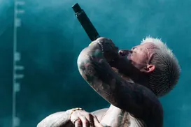 Cantor famoso fica irreconhecível após transplante capilar - Imagem