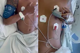 Jovem tetraplégico mexe os braços após tratamento revolucionário - Imagem