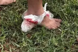 Medo: ataque de piranhas deixa dez feridos em rio no interior da Bahia - Imagem