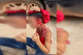 Mulher trans é atacada por homem com barra de ferro - Imagem