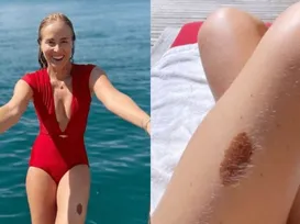 Angélica faz confissão inesperada sobre ‘pinta famosa’ - Imagem