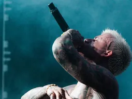 Cantor famoso fica irreconhecível após transplante capilar - Imagem