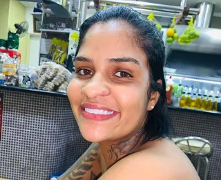 Mulher atropelada e arrastada pelo ex passará por nova amputação