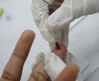 Registro de HIV entre idosos aumenta 441% em 10 anos e preocupa especialistas