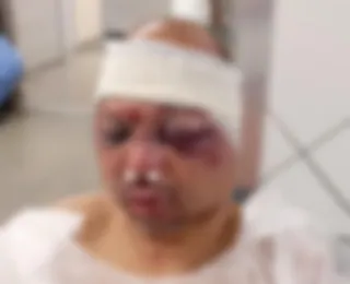 Rodoviário de Salvador é espancado por moradores após suspeita de aliciar adolescente