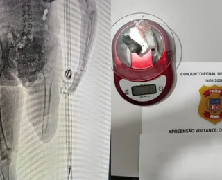 Mulher tenta entrar em presídio com material proibido dentro da muleta