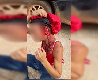 Mulher trans é atacada por homem com barra de ferro