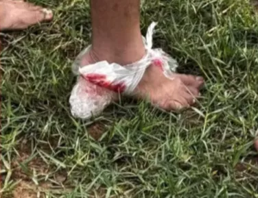 Medo: ataque de piranhas deixa dez feridos em rio no interior da Bahia - Imagem