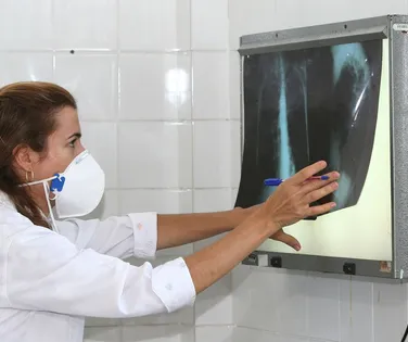 Brasil não atinge meta da OMS e tem aumento de casos de tuberculose - Imagem