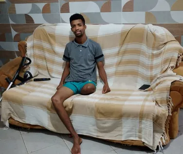 "Se não demorasse tanto tinha como recuperar", diz entregador amputado - Imagem