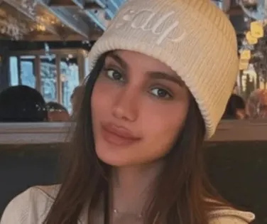 Vai fazer mais? Anitta rebate críticas sobre procedimentos estéticos - Imagem