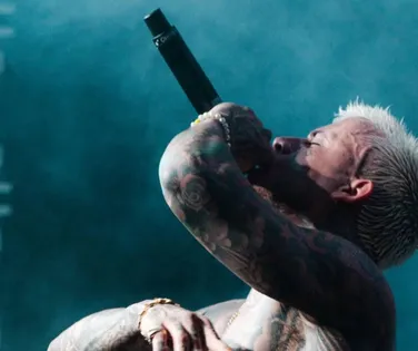 Cantor famoso fica irreconhecível após transplante capilar - Imagem