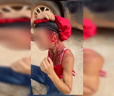 Mulher trans é atacada por homem com barra de ferro - Imagem