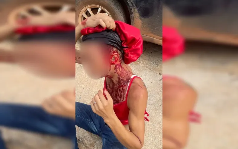 Mulher trans é atacada por homem com barra de ferro - Imagem