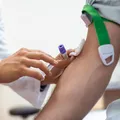 Alzheimer pode ser identificado por novo exame de sangue; entenda imagem
