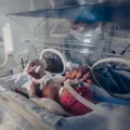 Composto plástico pode ter ligação com 2 milhões de partos prematuros imagem