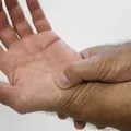 Conheça tratamentos garantidos pelo SUS a pessoas com fibromialgia imagem