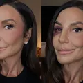 Ivete Sangalo desabafa sobre cirurgia delicada: “Quebrei dois ossos” imagem