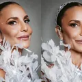 Ivete Sangalo expõe sequelas de cirurgia delicada no rosto imagem