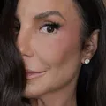 Ivete Sangalo surge com hematoma no rosto e brinca sobre aparência imagem