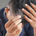 Minoxidil pode causar impotência? Veja o que dizem especialistas imagem
