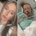 Mulher é atacada por cachorro e fica com rosto desfigurado imagem