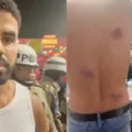 PMs são afastados após denúncia de agressões e homofobia no Carnaval imagem