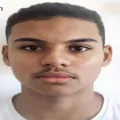 Raiva humana: adolescente de 17 anos morre após mordida de sagui imagem