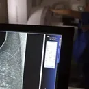 Teste genético que prevê risco de câncer de mama será feito no SUS