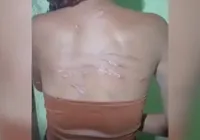 Adolescente é chicoteada em “tribunal do crime” após suspeita de ser “X9” imagem