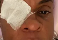 Atriz global desabafa após perder visão com pomada: "Dor avassaladora"