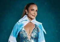 Ivete Sangalo recebe alta após cirurgia delicada no rosto imagem