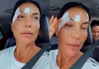 Ivete Sangalo recebe alta médica após desmaiar e ser internada imagem