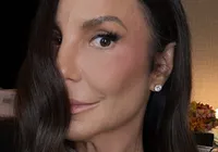 Ivete Sangalo surge com hematoma no rosto e brinca sobre aparência
