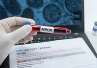 Mpox: Brasil chega a 90 casos com mais dois estados na lista imagem