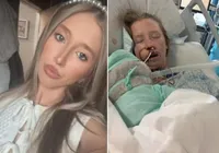 Mulher é atacada por cachorro e fica com rosto desfigurado imagem