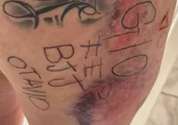 Mulher é torturada, tatuada à força e agredida por companheiro