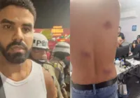 PMs são afastados após denúncia de agressões e homofobia no Carnaval imagem