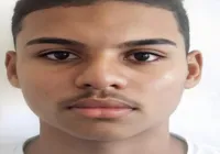 Raiva humana: adolescente de 17 anos morre após mordida de sagui