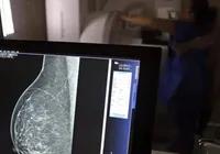 Teste genético que prevê risco de câncer de mama será feito no SUS