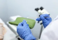 Universidade oferece atendimentos ginecológicos gratuitos em Salvador imagem