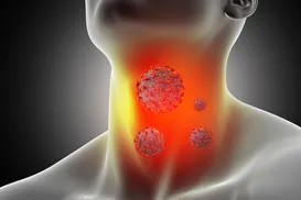 Advogado descobre câncer após ignorar caroço no pescoço - Imagem
