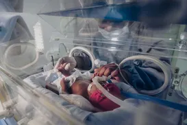 Composto plástico pode ter ligação com 2 milhões de partos prematuros - Imagem