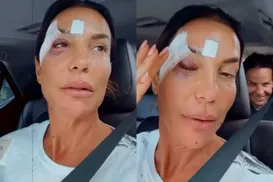 Ivete Sangalo recebe alta médica após desmaiar e ser internada - Imagem